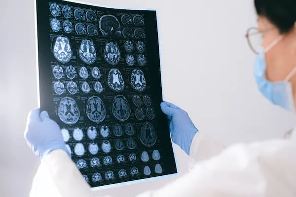 X-ray visualization of a human brain used in neuromarketing studies